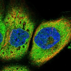 IQCH Antibody, Novus Biologicals 0.1mL; Unlabeled:Antibodies, Polyclonal